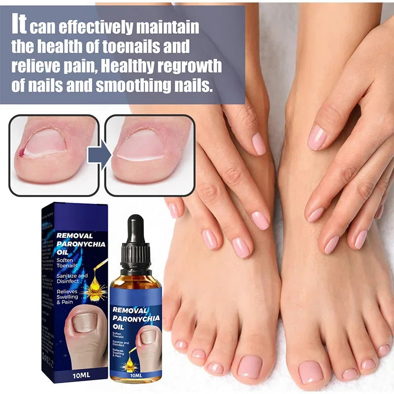 Anti Paroniquia - Aceite Reparador