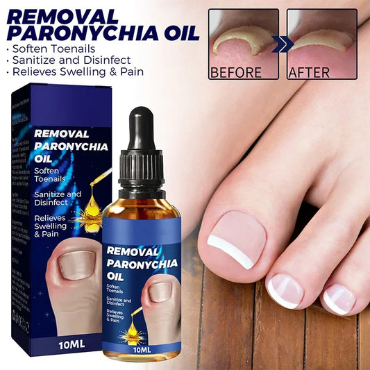 Anti Paroniquia - Aceite Reparador
